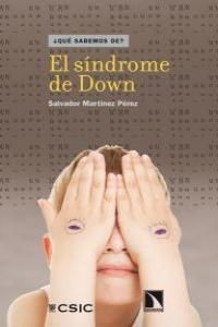 EL SÍNDROME DE DOWN