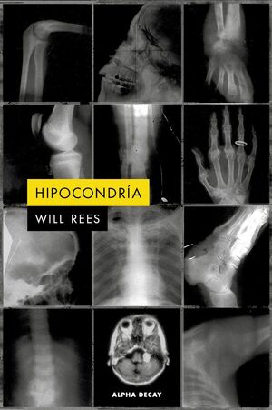 HIPOCONDRÍA